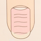 爪の溝